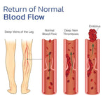 KneeRelief™ — Experience Instant Comfort & Mobility Today!