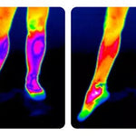 KneeRelief™ — Experience Instant Comfort & Mobility Today!