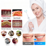 BrightSmilePro™ — Achieve a Radiant Smile in Just One Use