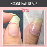 NailGuard™ — Achieve Stronger, Healthier Nails in Just 7 Days