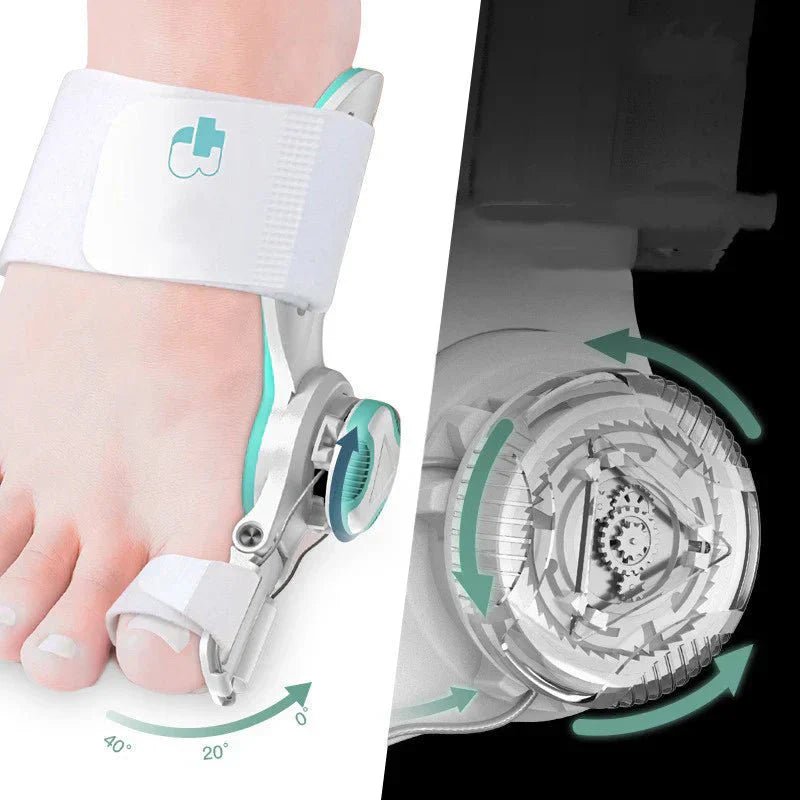 ToeAlign™ - Realign Your Toes & Relieve Pain in 30 Minutes!