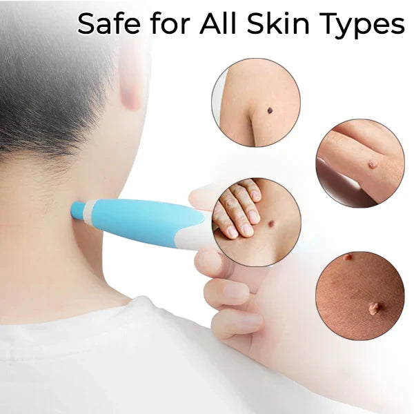 GlowAway™ — Painlessly Banish Skin Tags in Just Days!