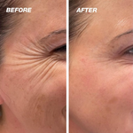 DermCare™ - Achieve Flawlessly Smooth Skin in Just 2 Weeks!