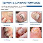 MycoStop™ - Restore Healthy Nails in Just Weeks!