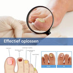 MycoStop™ - Restore Healthy Nails in Just Weeks!