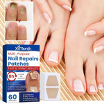 MycoStop™ - Regain Healthy Nails & Confidence in Weeks!